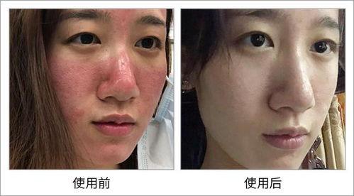 美国产品过敏事件视频,惊心动魄的生存挑战